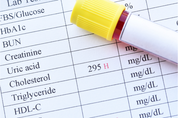prebiotics and metabolic health